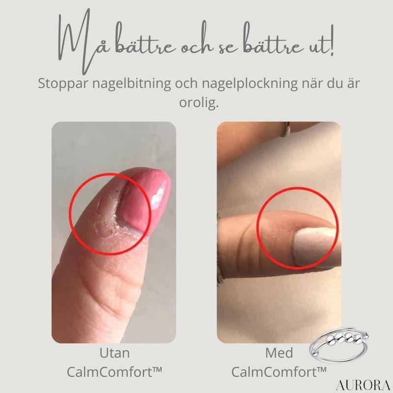 CalmComfort™ - Justerbar pärl-ring | 1+1 GRATIS TILLFÄLLIGT - Aurora Stockholm