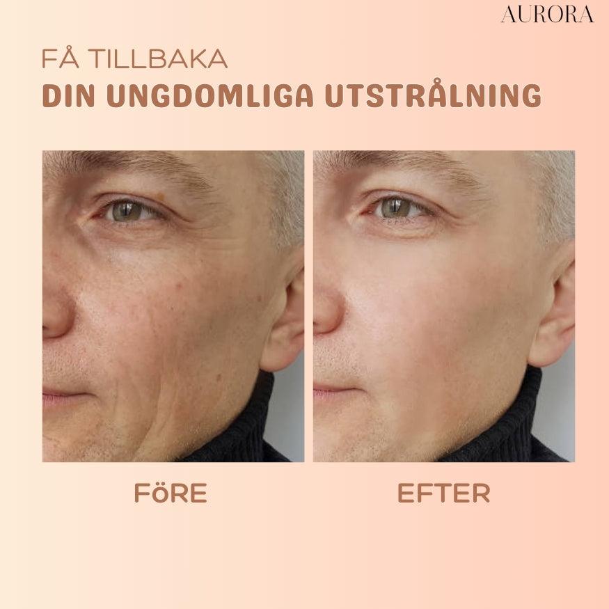 1+1 GRATIS SISTA DAGEN | MultiBalm™ - hudförnyande stift mot rynkor - Aurora Stockholm