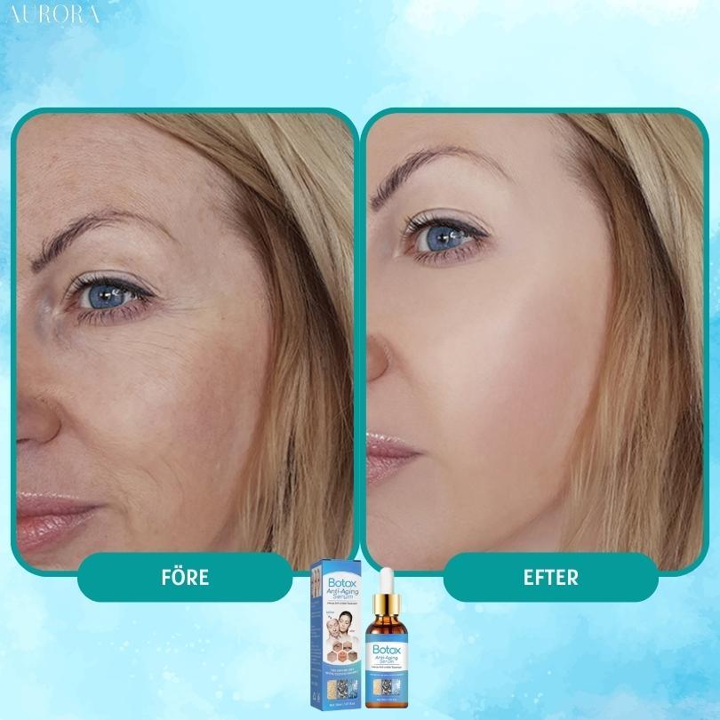 SISTA CHANSEN 1+1 GRATIS | YouthGlow™ | Botox Antialterung Serum - Aurora Stockholm